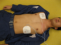 横たわっている傷病者の胸部に電極パッドを直接貼り付けている写真